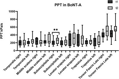 Algometer Assessment of Pressure Pain Threshold After Onabotulinumtoxin-A and Physical Therapy Treatments in Patients With Chronic Migraine: An Observational Study